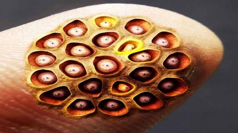Trypophobia