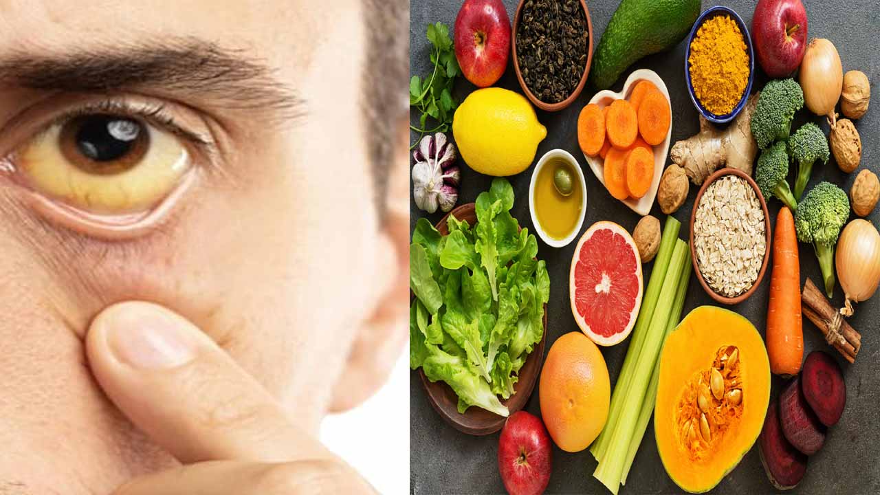 Diet For Jaundice diet-for-jaundice