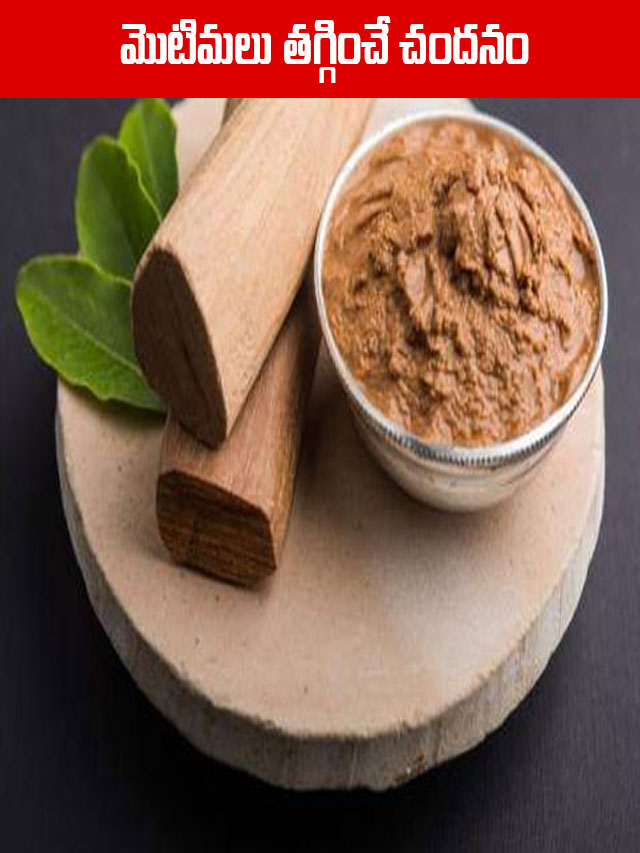 మొటిమ‌లు త‌గ్గించే చంద‌నం.. TV9 Telugu Healthy Skin Care Tips Telugu