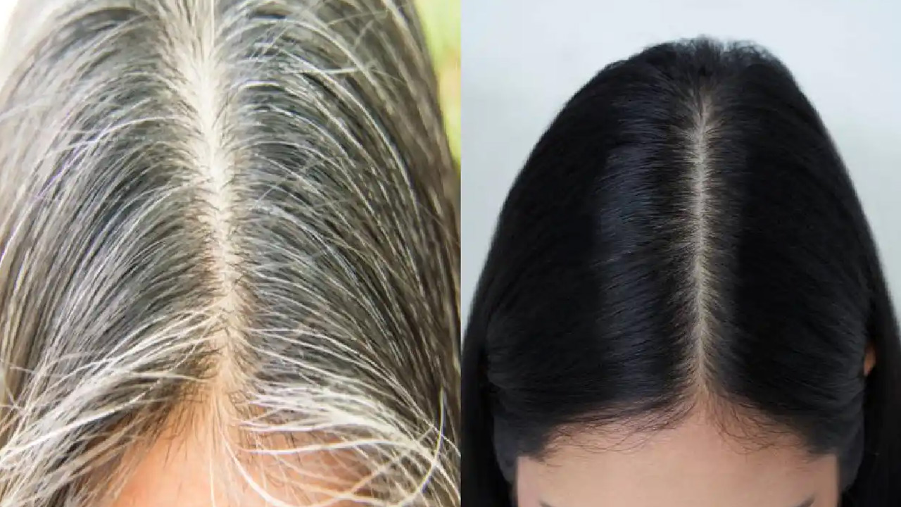 White Hair Solution: తెల్లజుట్టుకు శాశ్వత పరిష్కారం! ఇలాంటి సూపర్‌ఫుడ్‌తో  మెరిసే అందమైన శిరోజాలు.. | Black of this vitamin whiteness of hair so  include these things in diet | TV9 Telugu