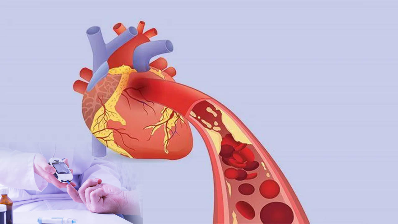 silent-heart-attack-50-percent-of-diabetic-patients-have-heart-disease