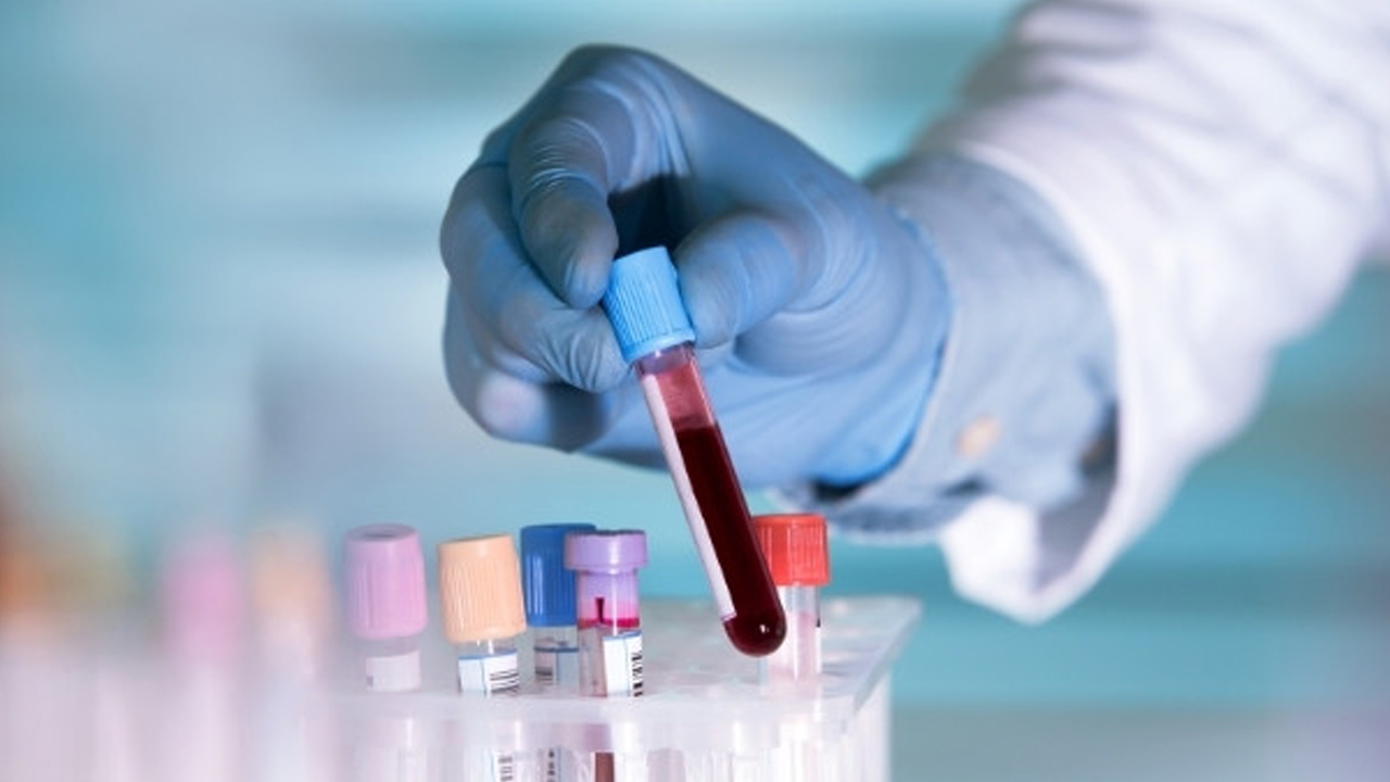 Artificial Blood: A rare discovery in medical science.. Researchers who ...